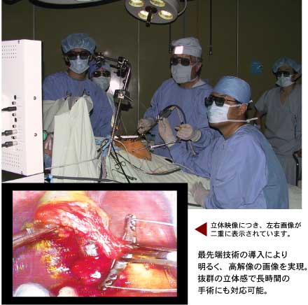 立体内視鏡につき、左右画像が二重に表示されています。